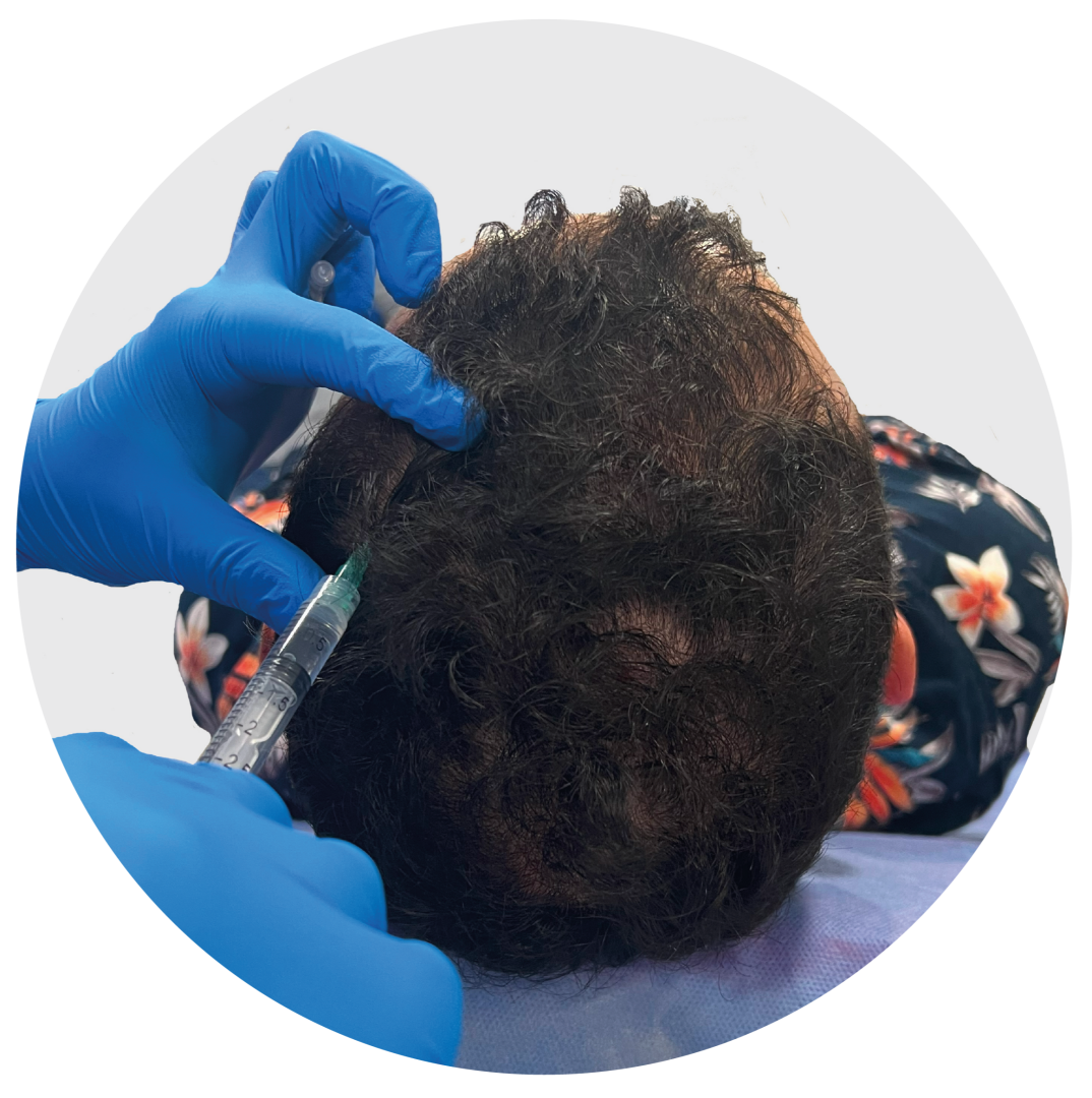 Diplomado Universitario en Tricología